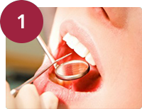 Implantes dentales